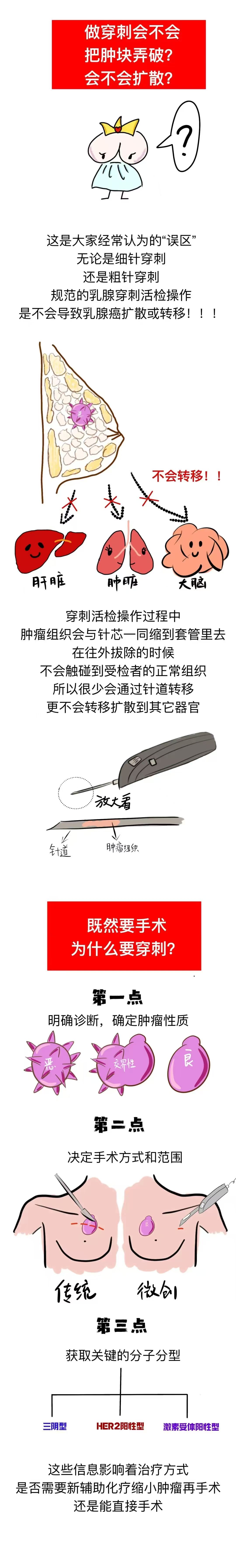 【尚医科普】粉红丝带月,这份漫画带你读懂乳腺健康的“关键一环”!